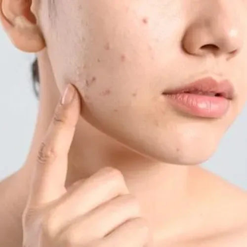 Skin disease Ayurvedic treatment