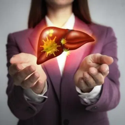Herbal liver support